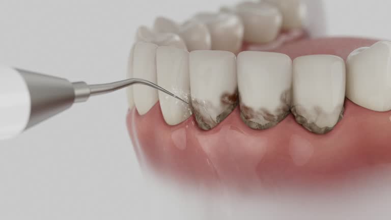 Reliable Emergency Dentist contractor in Clarkson Valley, MO by Smile Center Dentistry
